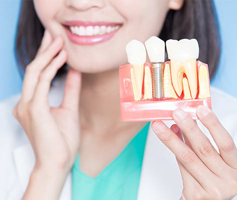 Dental Implants | Saba Road Dental Center | Richmond, BC